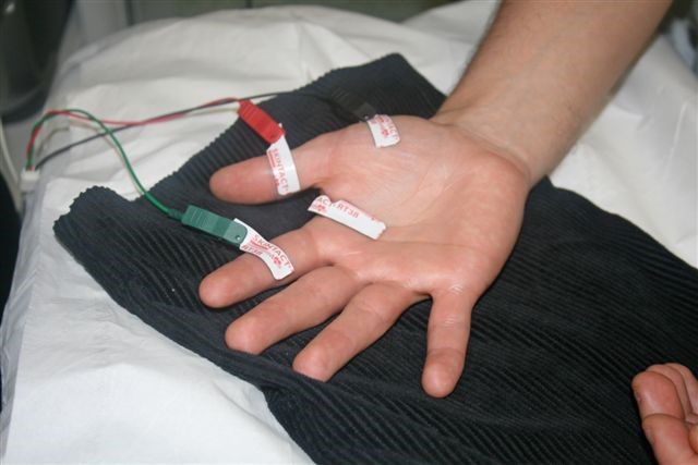 Stickers and wires stuck on a person's head ready for a test.