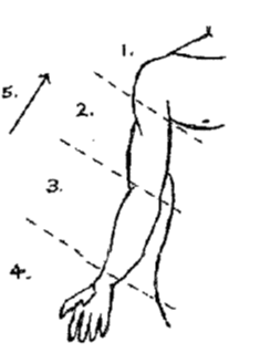 A diagram of person's arm with numbers one to five listed, illustrating instructions.