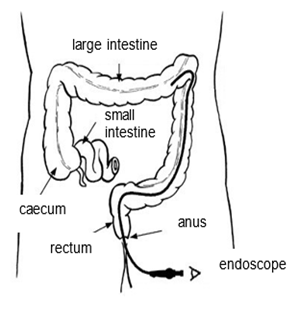 A diagram of a person's large and small intestines.