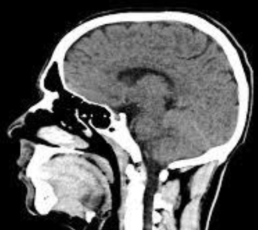 A CT scan of a person's head.